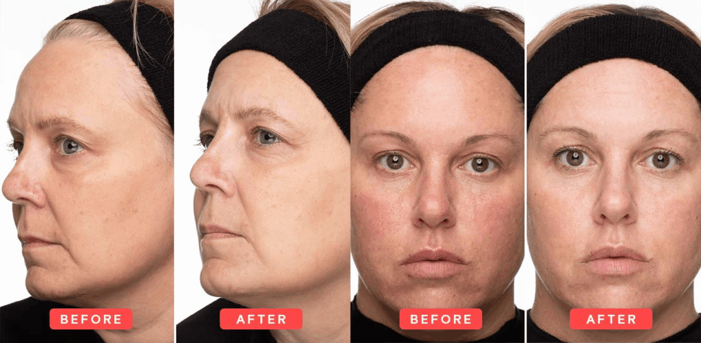 The effects of Ascorbyl Tetraisopalmitate 5 588d41a9fd79723a44896cc974de3be7